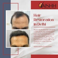 Hair Loss Treatment.jpg